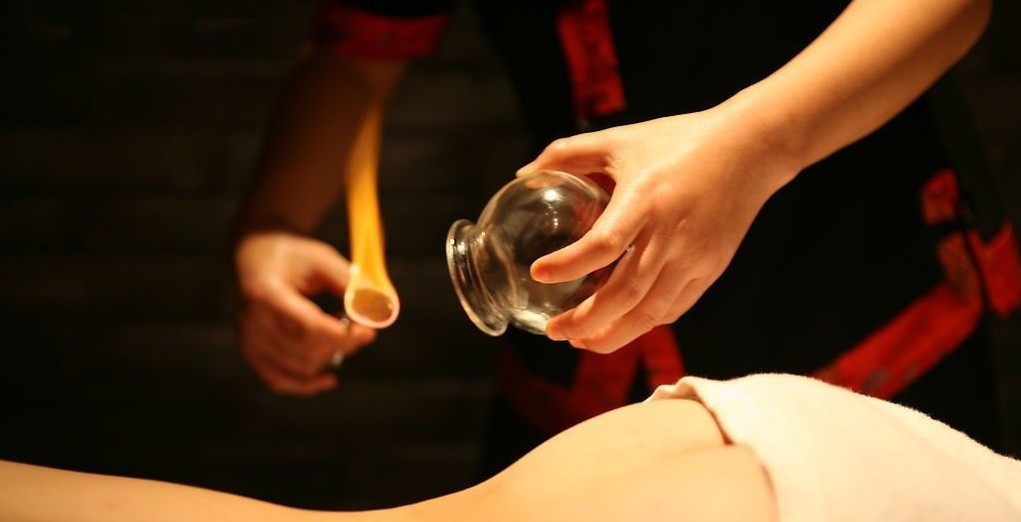 Cupping solution