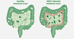 Get to Know Small Intestinal Bacterial
