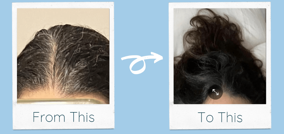hair