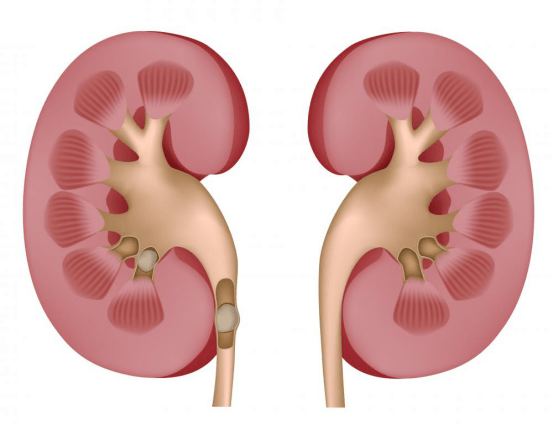 kidney