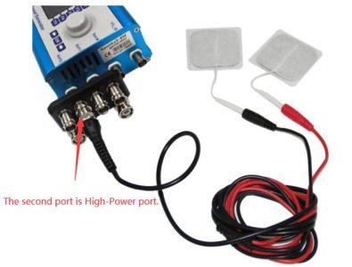 TENS-pad XM - Tens Pads