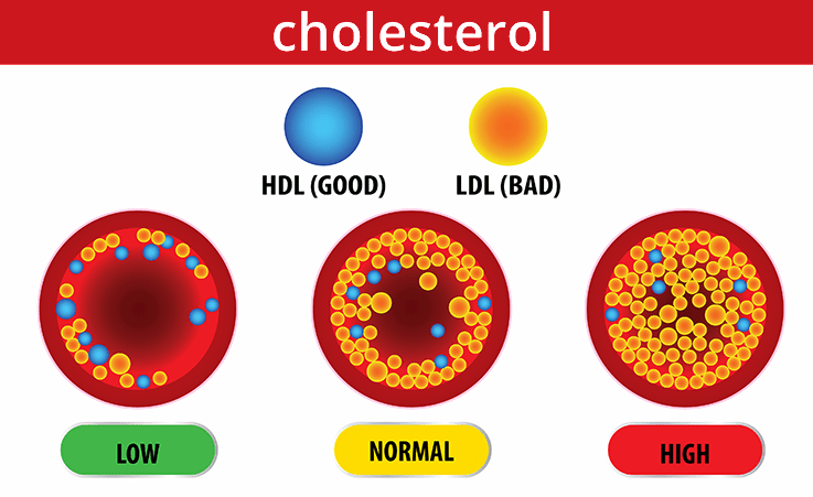 cholesterol-graphic