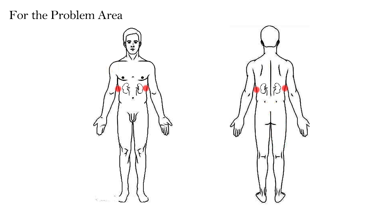 The Problem Area