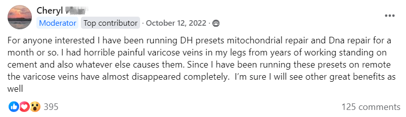 Since using Spooky2, my varicose veins have almost disappeared completely
