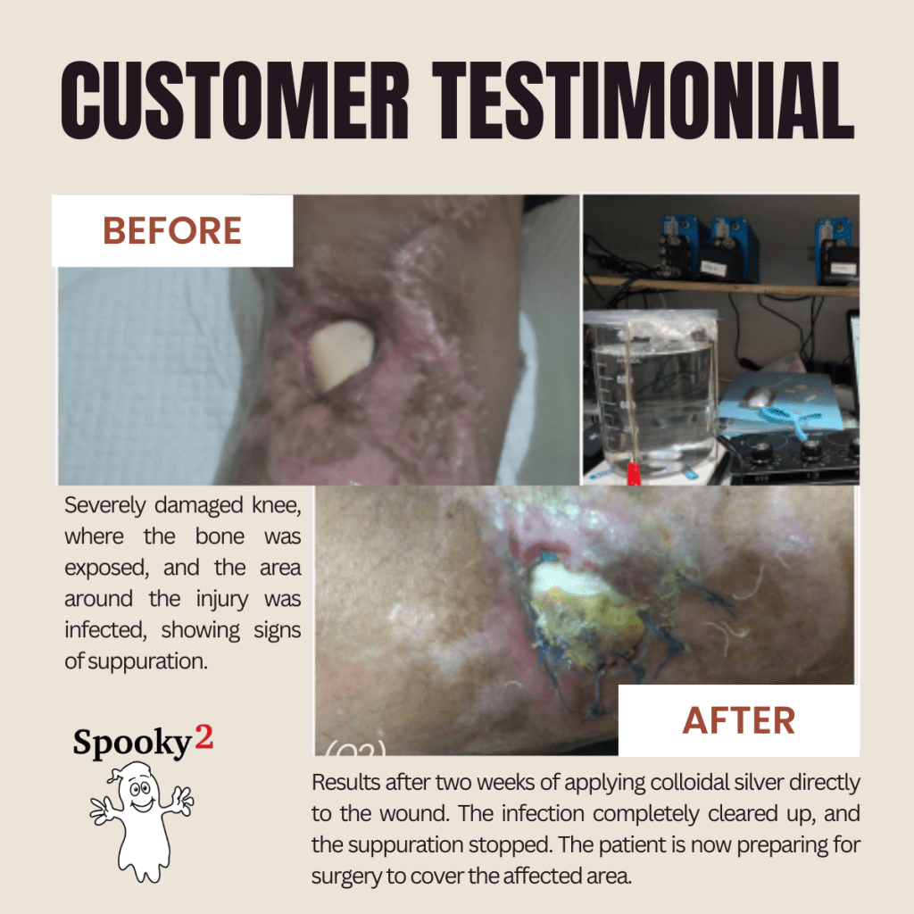 The Power of Colloidal Silver in Healing a Damaged Knee