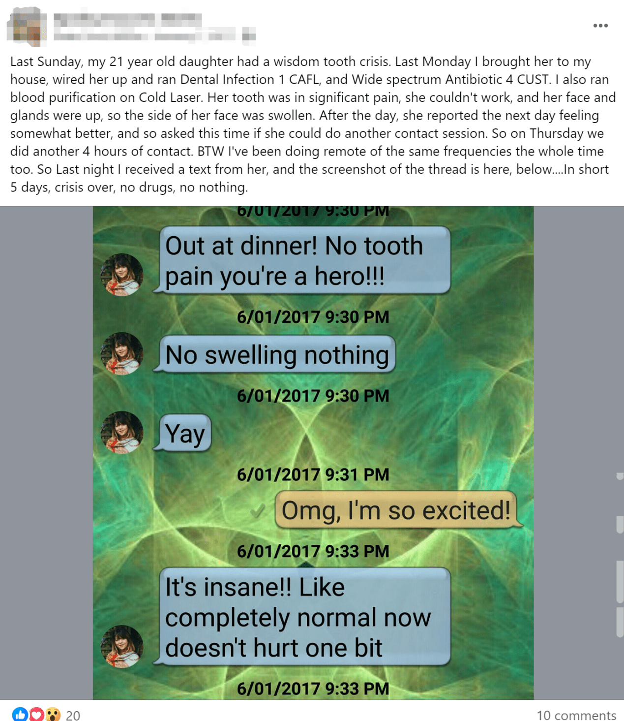Case 11: Last Sunday, My 21-Year-Old Daughter Had a Wisdom Tooth Crisis
A user successfully treated their daughter’s wisdom tooth crisis using Spooky2’s dental infection presets. After five days of using Spooky2, the crisis was over, and no dental intervention was required.