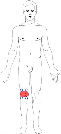 Knee