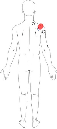 Shoulder