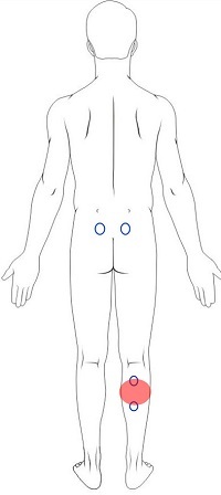Calf Pain