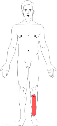 Shin Pain