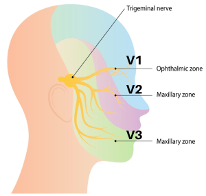 What Is Trigeminal Neuralgia(1)