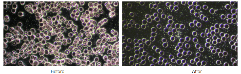 Let's take a look at the before and after pictures of blood cells after 45 minutes of using cold laser solution.