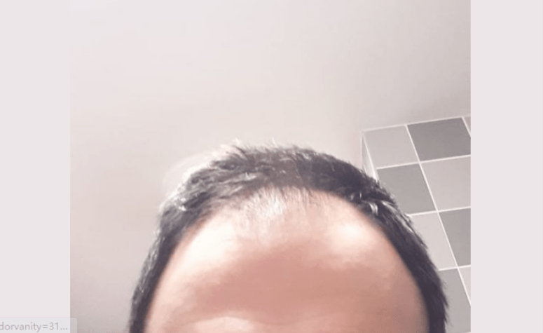 hair 5